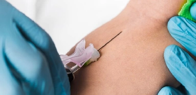 Injection for Tendonitis