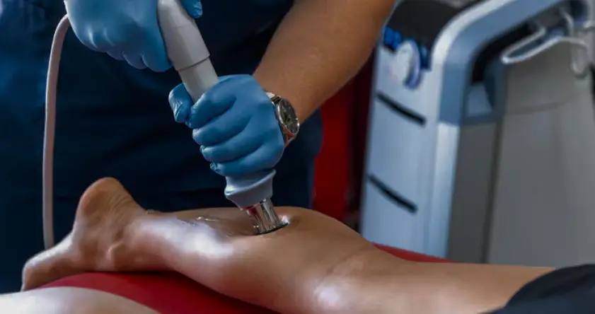 Radio Frequency Ablation