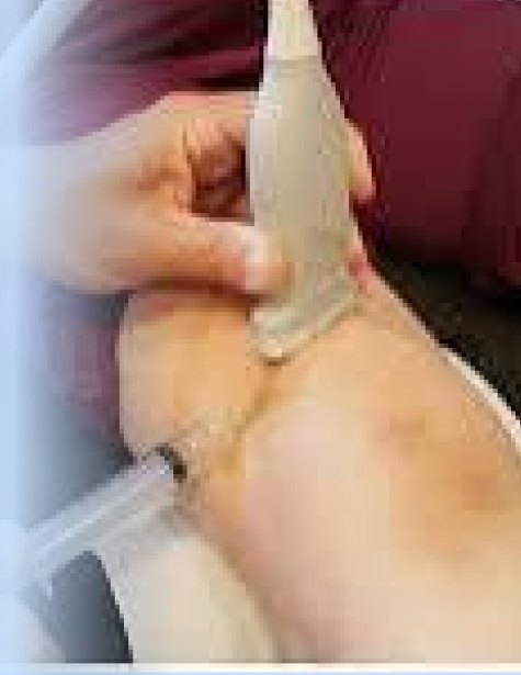 Ultrasound-Guided-Injection-under-02 Ultrasound Guided Injection