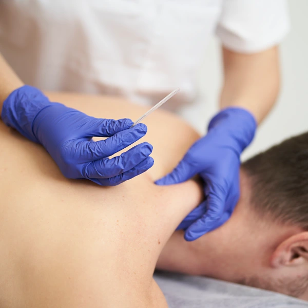 Targeted Cervical Nerve Root Block Injection in London