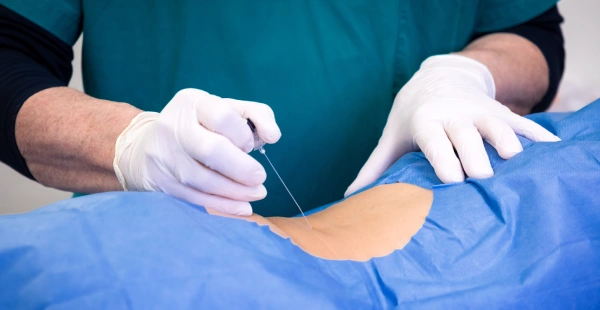 Image Guided Spinal Injection