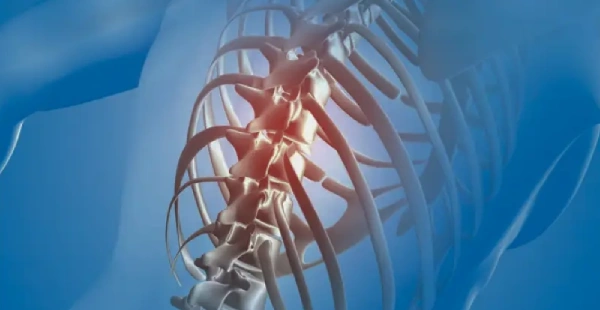 Kyphoplasty Surgery, Dr Purnajyoti Banerjee