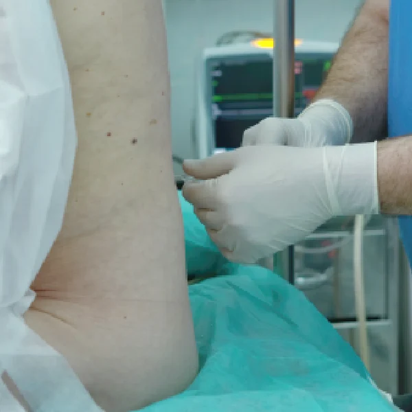 Targeted Spinal Nerve Root Block Injection in London