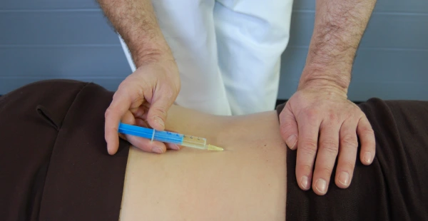 Transforaminal Epidural Injection