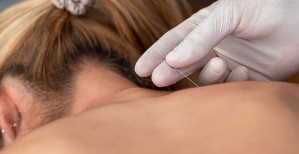 Trigger Point Injection