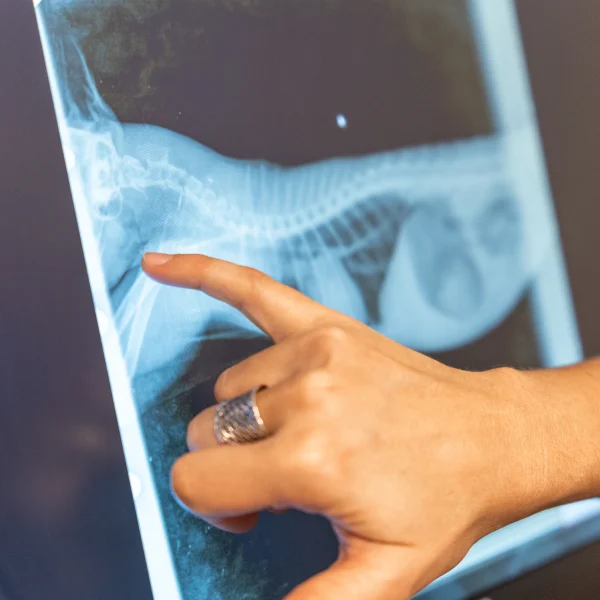 Targeted X-Ray Guided Injection in London