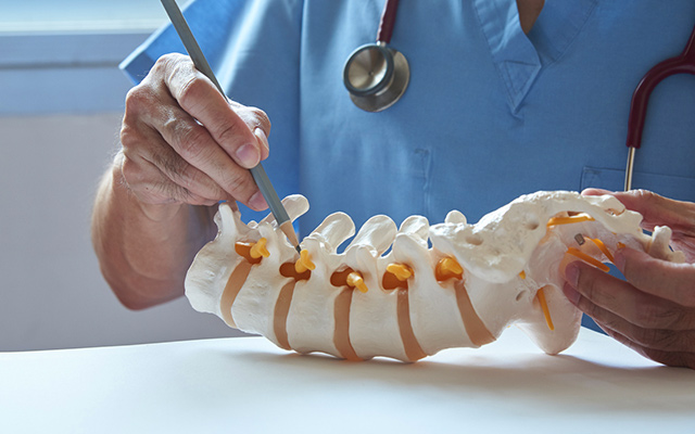 Doctor pointing to a lumbar spine model while explaining spinal anatomy, disc problems, and treatment options.